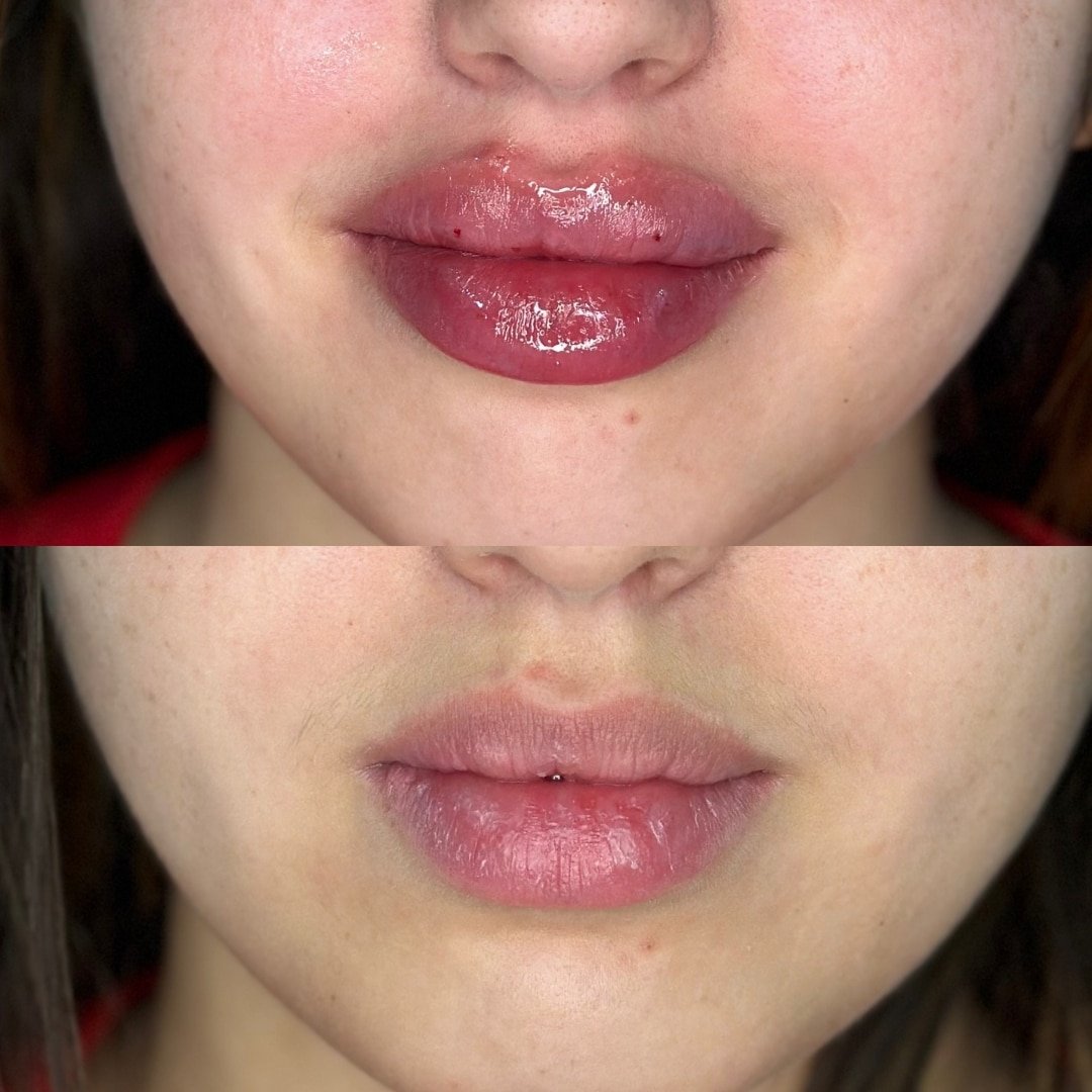 Labios