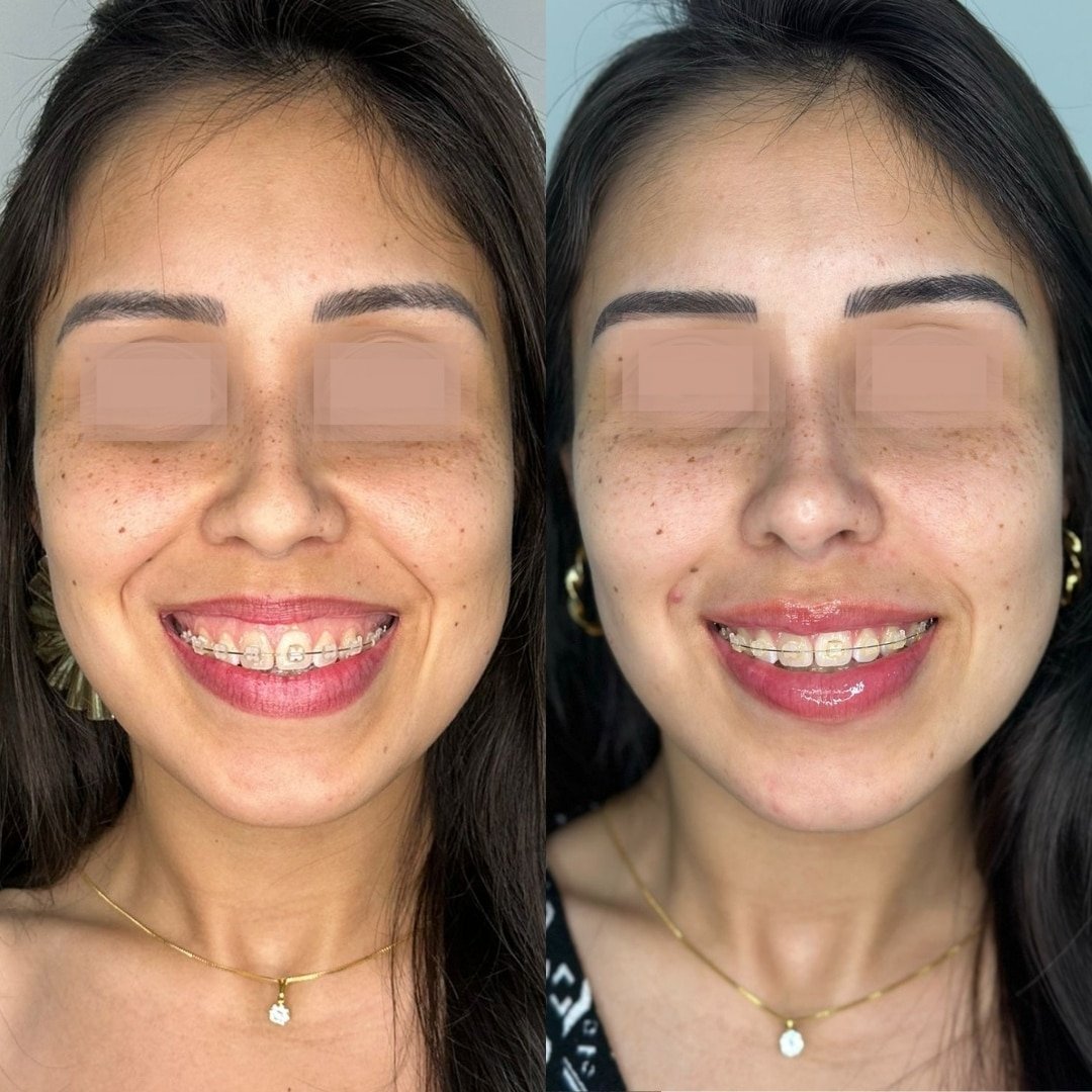 Sorrigo Geng Dra. Endiara V2